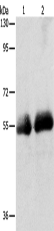 兔抗SLC5A5多克隆抗体