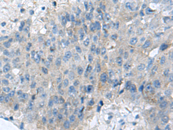 兔抗KIAA0556多克隆抗体