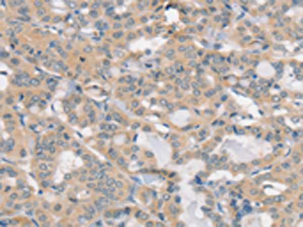 兔抗SLC6A8多克隆抗体