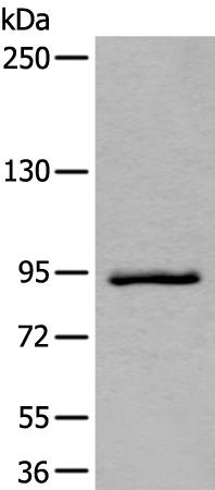 兔抗ZBTB10多克隆抗体   