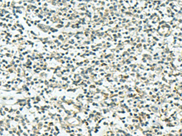 兔抗KIF3B多克隆抗体