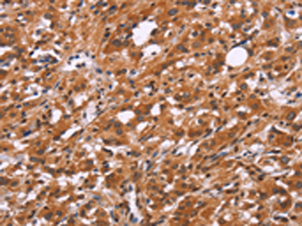 兔抗SLC8A2多克隆抗体