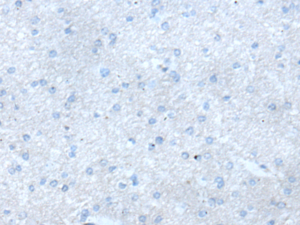 兔抗PNLIPRP1多克隆抗体
