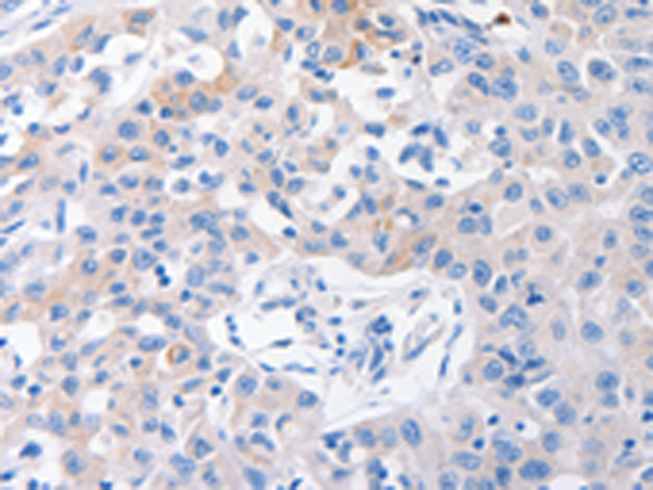 兔抗SLC10A1多克隆抗体