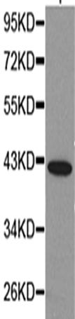 兔抗KIR2DL1多克隆抗体