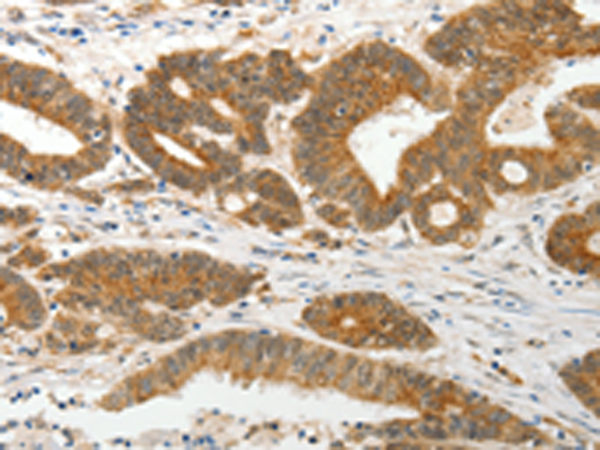 兔抗SLC12A1多克隆抗体 