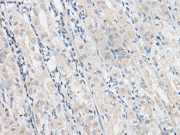 兔抗SLC12A3多克隆抗体