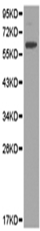 兔抗KIR2DL3多克隆抗体