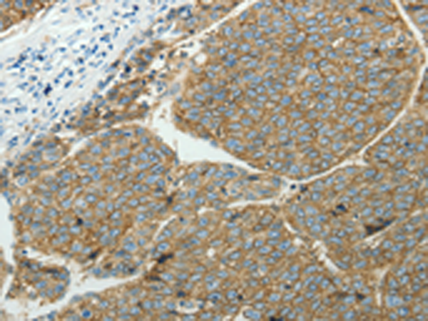 兔抗SLC16A1多克隆抗体