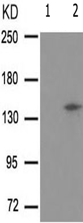 兔抗KIT(Phospho-Tyr703) 多克隆抗体