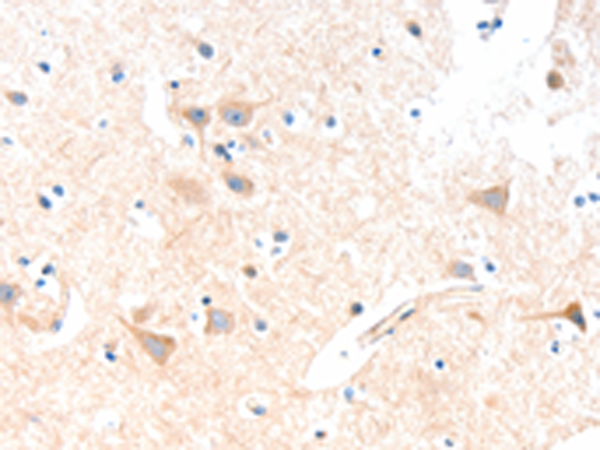 兔抗SLC19A2多克隆抗体