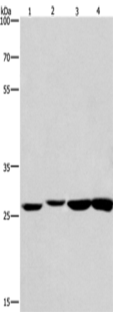 兔抗KLF7多克隆抗体