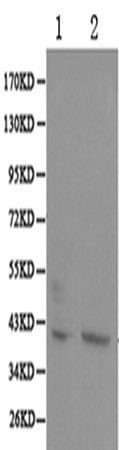 兔抗POLR1C多克隆抗体