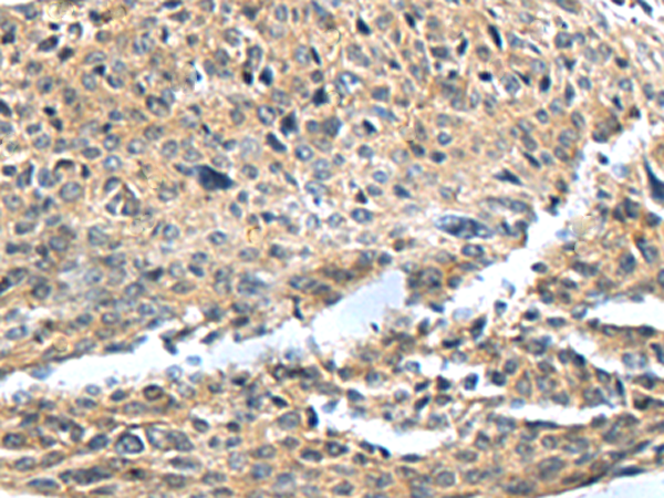 兔抗SLC22A12多克隆抗体