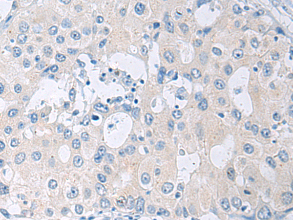 兔抗SLC23A1多克隆抗体