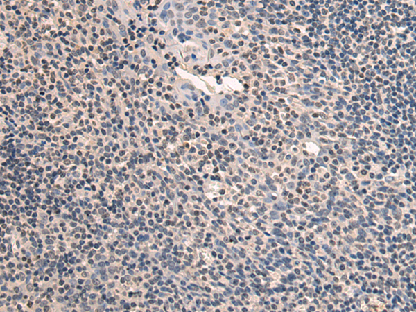 兔抗SLC24A1多克隆抗体