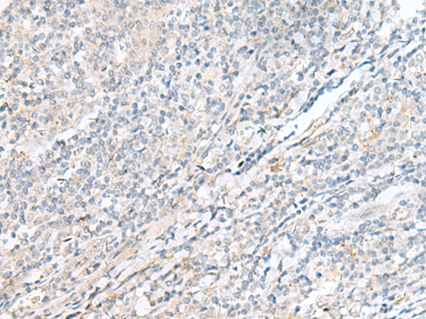 兔抗POMGNT1多克隆抗体