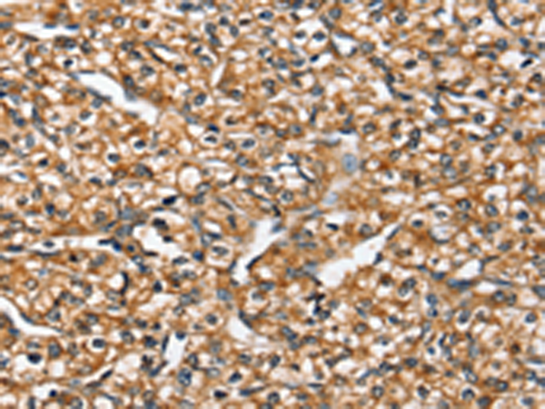 兔抗SLC26A5多克隆抗体