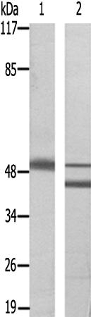 兔抗ZIC1/2/3多克隆抗体
