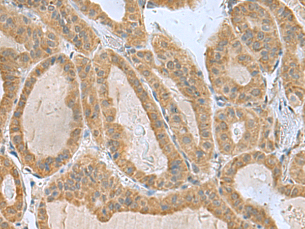 兔抗SLC30A6多克隆抗体 