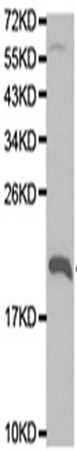 兔抗KLRD1多克隆抗体  