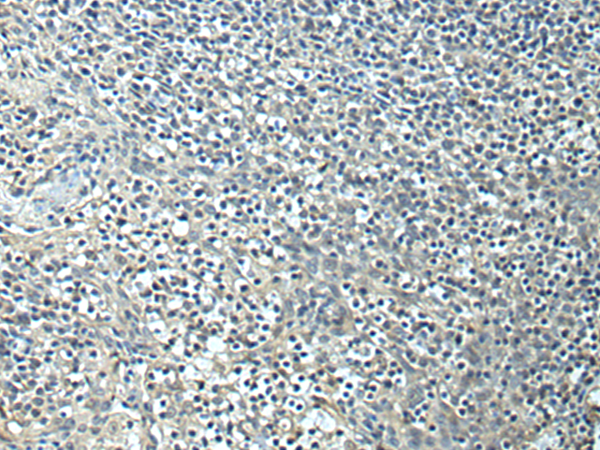 兔抗SLC35F6多克隆抗体