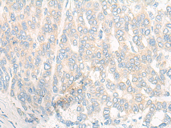 兔抗SLC39A4多克隆抗体 
