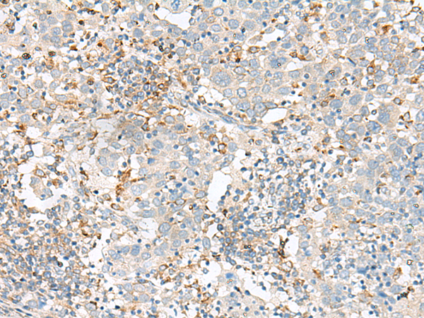 兔抗SLC41A3多克隆抗体