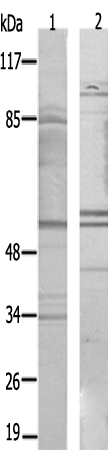兔抗PPHLN1多克隆抗体