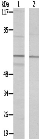 兔抗SLC43A1多克隆抗体