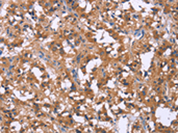 兔抗SLC52A1多克隆抗体