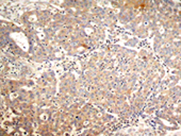 兔抗KRT18 (Phospho-Ser33)多克隆抗体