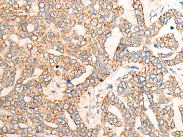 兔抗PPM1D多克隆抗体