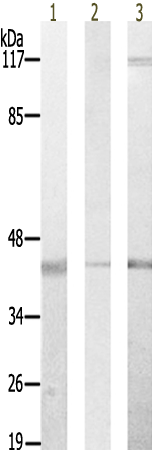 兔抗PPP1R2(Ab-44) 多克隆抗体