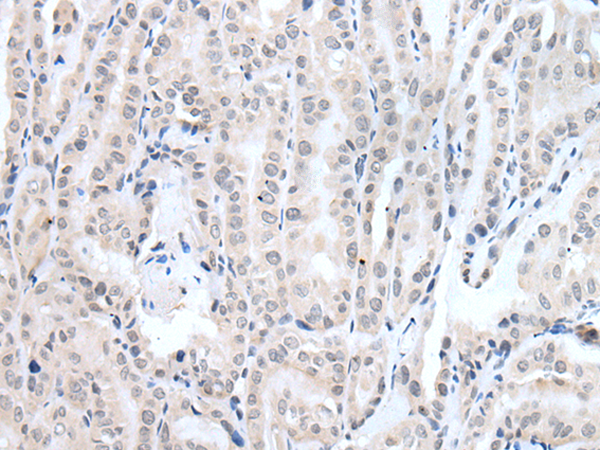 兔抗PPP1R42多克隆抗体