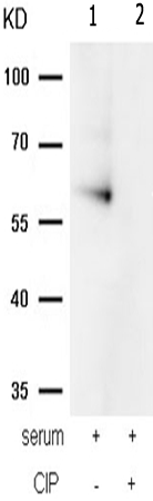兔抗PRKAA1 PRKAA2(Phospho-Thr183 Thr172)多克隆抗体 