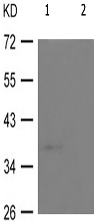 兔抗PRKAB1(Phospho-Ser181) 多克隆抗体