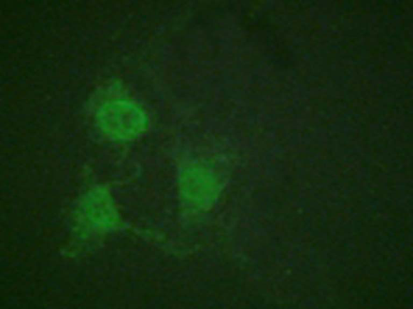 兔抗PRKACA(Phospho-Thr197) 多克隆抗体