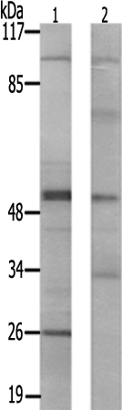 兔抗PRKAR2B(Ab-113) 多克隆抗体