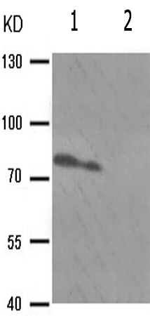 兔抗PRKCB(Phospho-Ser661) 多克隆抗体