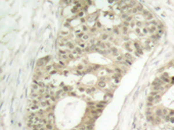 兔抗PRKCD (Phospho-Ser645)多克隆抗体