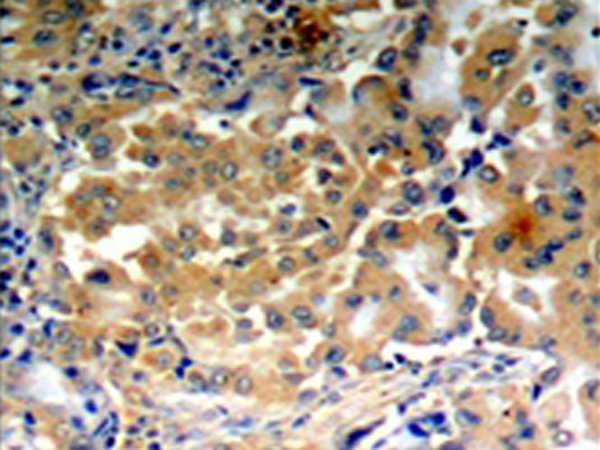 兔抗PRKCZ(Phospho-Thr410) 多克隆抗体