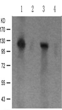 兔抗PRKD1 (Phospho-Ser910)多克隆抗体