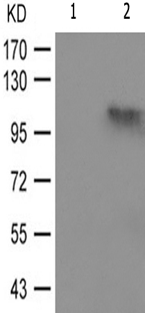 兔抗PRKD123(Phospho-Ser738742) 多克隆抗体