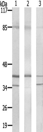 兔抗PRPF18多克隆抗体