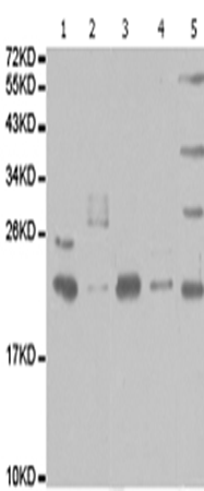 兔抗PSMB9多克隆抗体