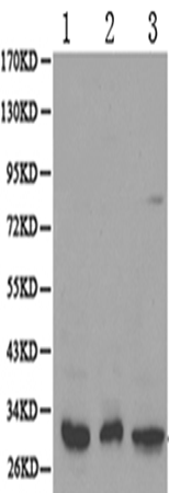 兔抗PSME3多克隆抗体
