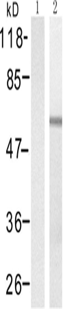 兔抗SMAD2 (Phospho-Thr220)多克隆抗体