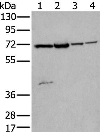 兔抗ZNF131多克隆抗体 