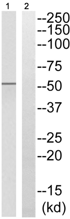 兔抗SMAD2(Phospho-Ser465) 多克隆抗体